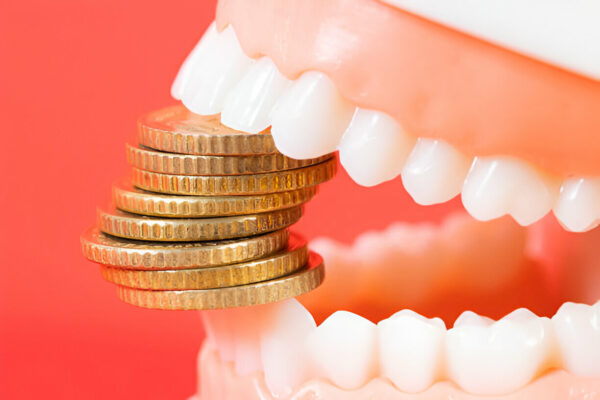 teeth implant financing